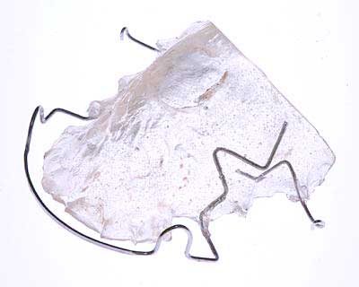 hàm nắn thông thường