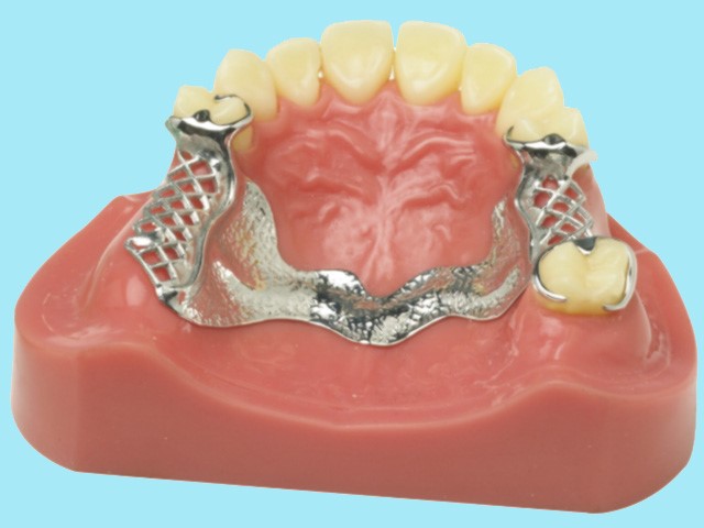 nền hàm sử dụng titanium