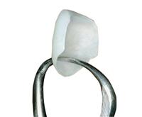 Mặt dán sứ Veneer