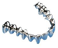 Răng kim loại toàn bộ