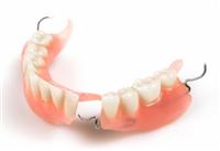 Tháo Lắp Nhựa Cứng