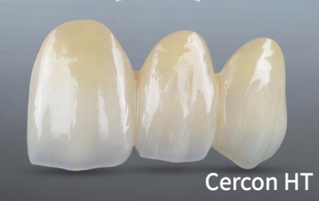 Răng sứ Cercon HT